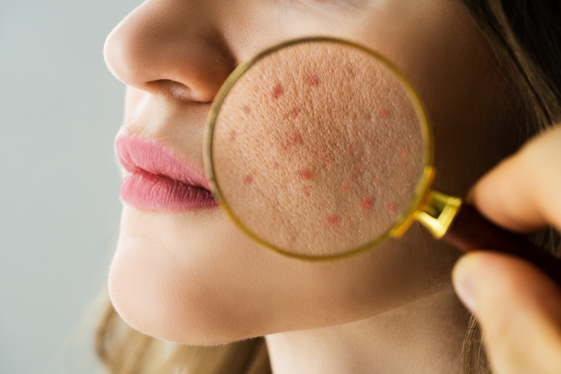 Close-up of skin under a magnifier